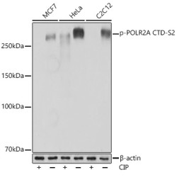 Phospho-POLR2A CTD-S2 Rabbit mAb