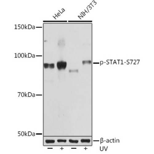 Phospho-STAT1-S727 Rabbit mAb