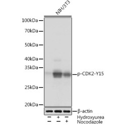Phospho-CDK2-Y15 Rabbit mAb