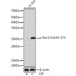 Phospho-Rac1/Cdc42-S71 Rabbit mAb