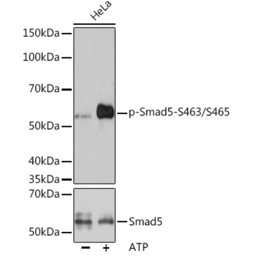 Phospho-Smad5-S463/S465 Rabbit mAb