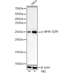 Phospho-eIF4E-S209 Rabbit mAb