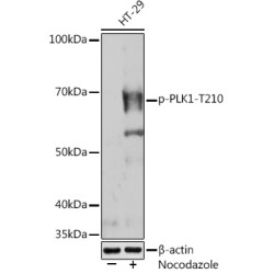 Phospho-PLK1-T210 Rabbit mAb