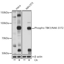 Phospho-TBK1/NAK-S172 Rabbit mAb