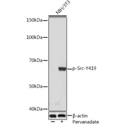 Phospho-Src-Y419 Rabbit mAb