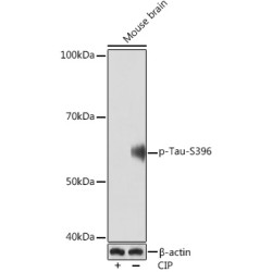 Phospho-Tau-S396 Rabbit mAb