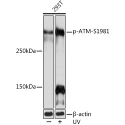 Phospho-ATM-S1981 Rabbit mAb