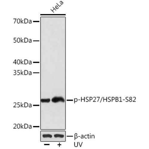 Phospho-HSP27/HSPB1-S82 Rabbit mAb