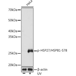 Phospho-HSP27/HSPB1-S78 Rabbit mAb