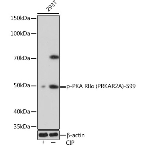 Phospho-PKA RIIα (PRKAR2A)-S99 Rabbit mAb
