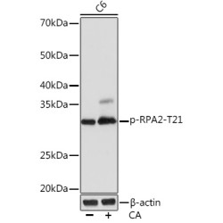 Phospho-RPA2-T21 Rabbit mAb