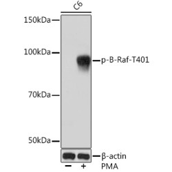Phospho-B-Raf-T401 Rabbit mAb