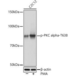 Phospho-PKC alpha-T638 Rabbit mAb