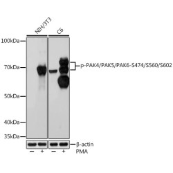 Phospho-PAK4/PAK5/PAK6-S474/S560/S602 Rabbit mAb