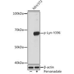 Phospho-Lyn-Y397 Rabbit mAb
