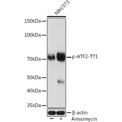 Phospho-ATF2-T71 Rabbit mAb