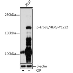 Phospho-ErbB3/HER3-Y1222 Rabbit mAb