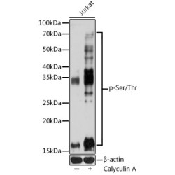 pan Phospho-Serine/Threonine Mouse mAb