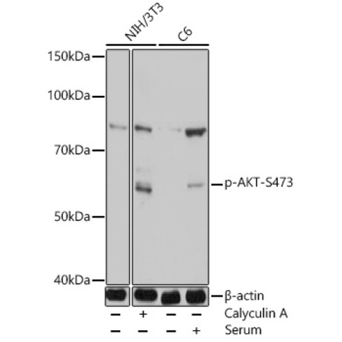 Phospho-Akt-S473 Rabbit pAb