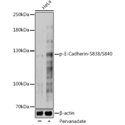 Phospho-E-Cadherin-S838/S840 Rabbit pAb