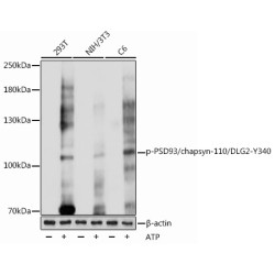 Phospho-PSD93/chapsyn-110/DLG2-Y340 Rabbit pAb