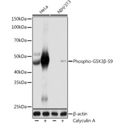 Phospho-GSK3β-S9 Rabbit mAb
