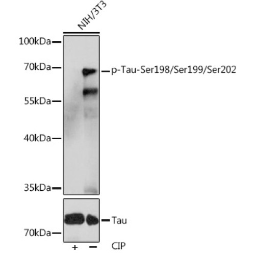 Phospho-Tau-Ser198/Ser199/Ser202 Rabbit pAb