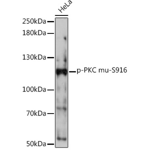 Phospho-PKC mu-S916 Rabbit pAb