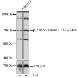 Phospho-p70 S6 Kinase 1-T421/S424 Rabbit pAb