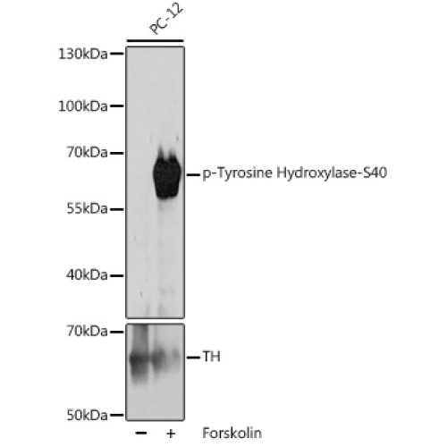 Phospho-Tyrosine Hydroxylase-S40 Rabbit pAb
