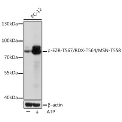 Phospho-EZR-T567/RDX-T564/MSN-T558 Rabbit pAb