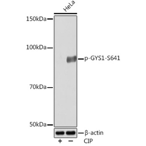 Phospho-GYS1-S641 Rabbit mAb