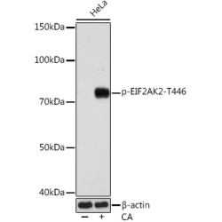 Phospho-PKR/EIF2AK2-T446 Rabbit mAb