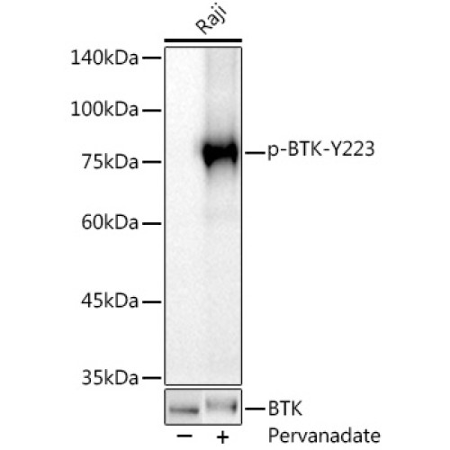 Phospho-BTK-Y223 Rabbit mAb