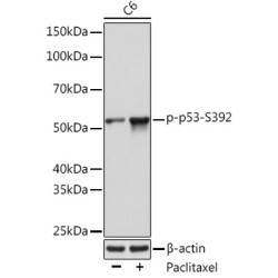 Phospho-p53-S392 Rabbit mAb