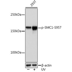 Phospho-SMC1-S957 Rabbit mAb