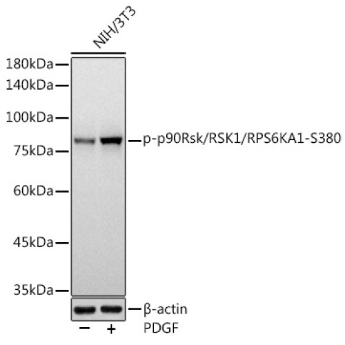 Phospho-p90Rsk/RSK1/RPS6KA1-S380 Rabbit mAb