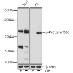 Phospho-PKC zeta-T560 Rabbit mAb