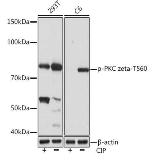 Phospho-PKC zeta-T560 Rabbit mAb