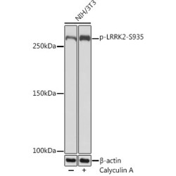 Phospho-LRRK2-S935 Rabbit mAb