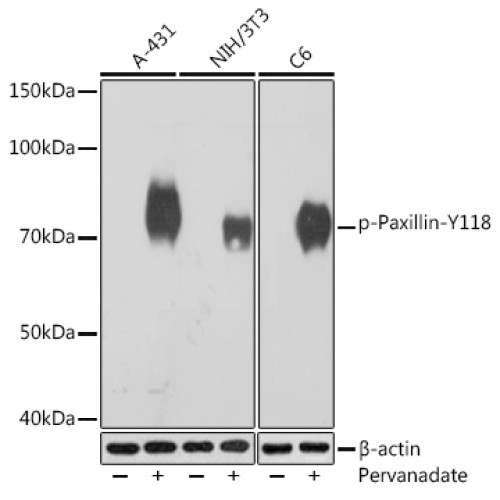 Phospho-Paxillin-Y118 Rabbit mAb