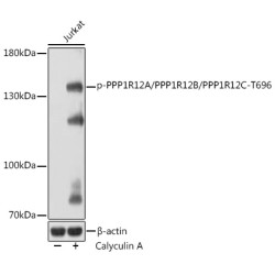 Phospho-PPP1R12A/PPP1R12B/PPP1R12C-T696 Rabbit pAb