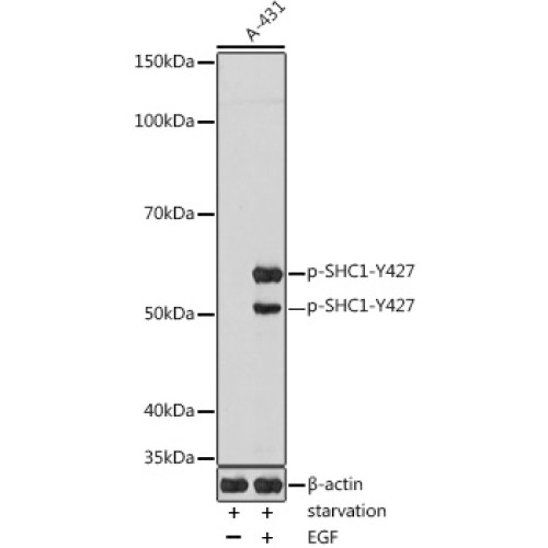 Phospho-SHC1-Y427 Rabbit pAb