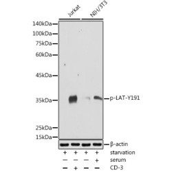 Phospho-LAT-Y191 Rabbit pAb