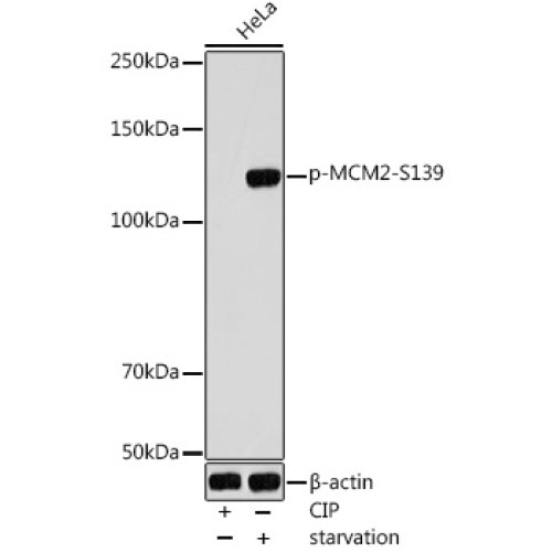 Phospho-MCM2-S139 Rabbit pAb