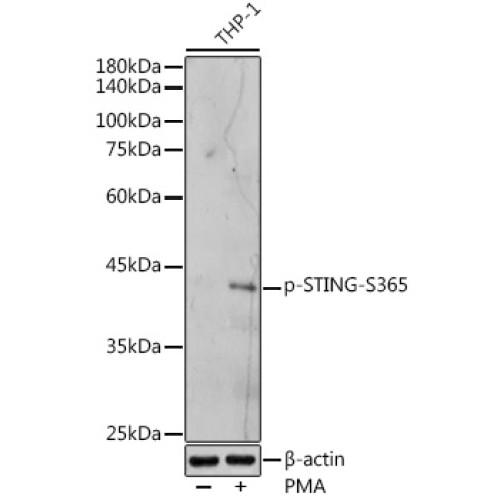 Phospho-STING/TMEM173-S365 Rabbit pAb