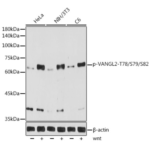 Phospho-VANGL2-T78/S79/S82 Rabbit mAb