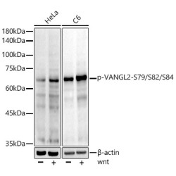 Phospho-VANGL2-S79/S82/S84 Rabbit mAb