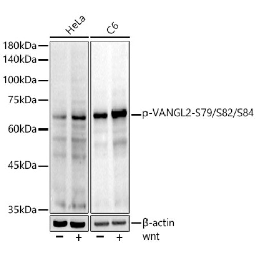 Phospho-VANGL2-S79/S82/S84 Rabbit mAb