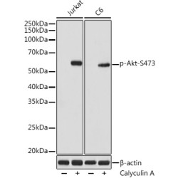 Phospho-Akt-S473 Rabbit mAb